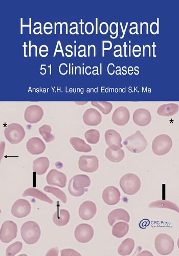 Haematology and the Asian Patient: 51 Clinical Cases