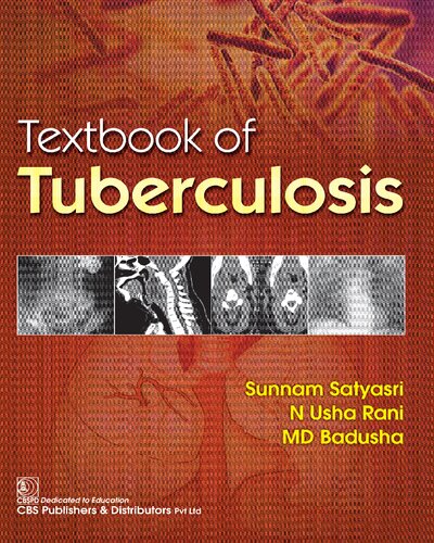 Textbook of Tuberculosis