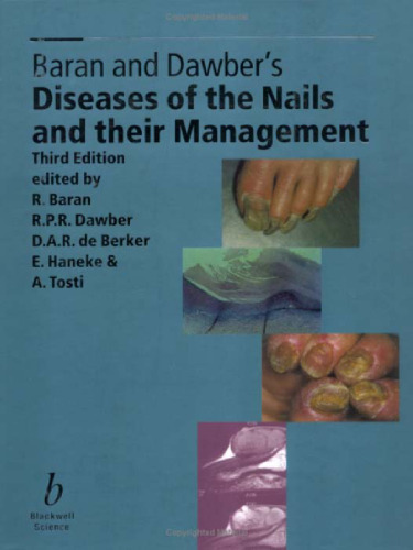 Diseases of the Nails and Their Management 3rd Edition
