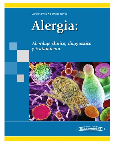 Alergía: abordaje clínico, diagnóstico y tratamiento