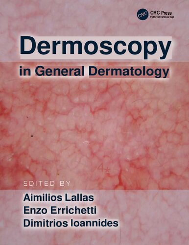 Dermoscopy in general dermatology