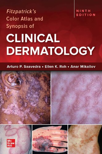 Fitzpatrick's Color Atlas and Synopsis of Clinical Dermatology,