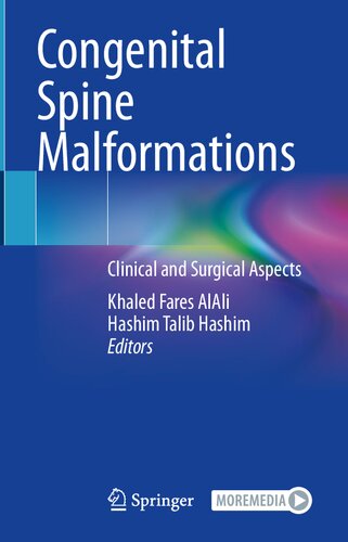 Congenital Spine Malformations: Clinical and Surgical Aspects