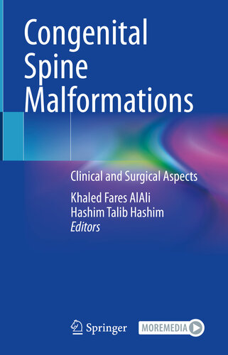 Congenital Spine Malformations: Clinical and Surgical Aspects