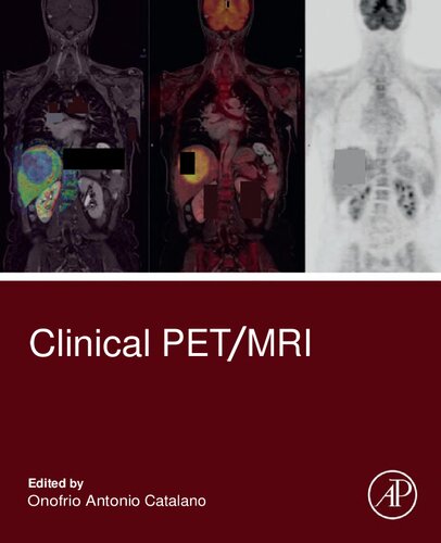 Clinical PET/MRI (Sep 21, 2022)_(0323885373)_(Academic Press).pdf