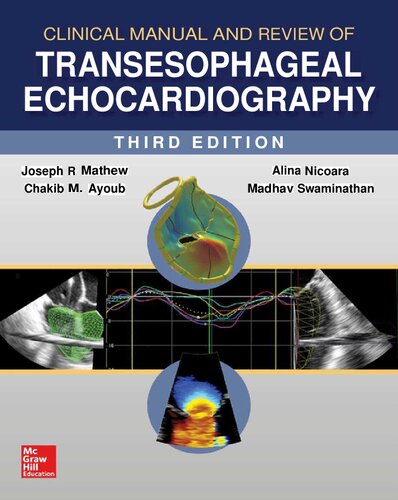 Clinical Manual and Review of Transesophageal Echocardiography