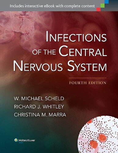 Infection of The CNS, 4e  (May 21, 2014)_(1451173725)_(LWW)