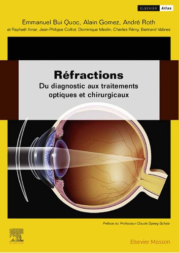 Réfractions : Du diagnostic aux traitements optiques et chirurgicaux