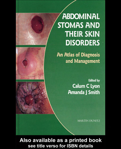Abdominal Stomas and Their Skin Disorders: An Atlas of Diagnosis and Management