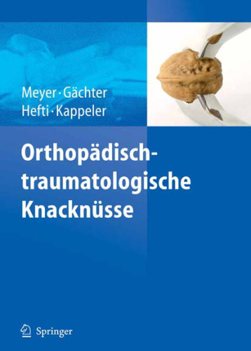 Orthopadisch-traumatologische Knacknusse (German Edition)