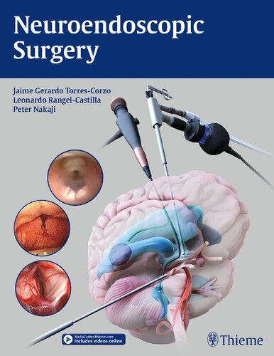 Neuroendoscopic Surgery