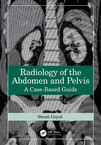 Radiology of the Abdomen and Pelvis - A Case-Based Guide (Sep 30, 2024)_(1032588780)_(CRC Press).pdf