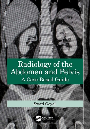 Radiology of the Abdomen and Pelvis - A Case-Based Guide (Sep 30, 2024)_(1032588780)_(CRC Press).pdf