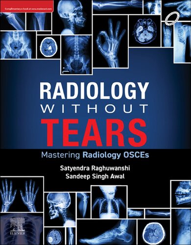 Radiology Without Tears - Mastering Radiology OSCEs (Aug 7, 2024)_(9788131269404)_(Elsevier India)
