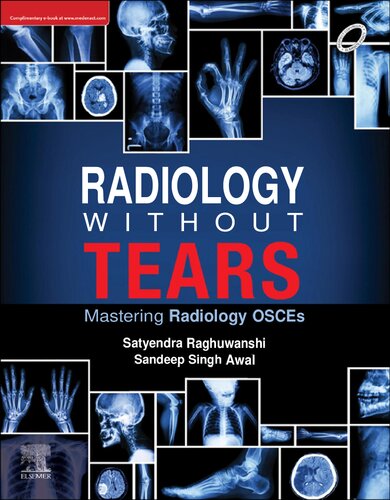 Radiology Without Tears - Mastering Radiology OSCEs (Aug 7, 2024)_(9788131269404)_(Elsevier India).pdf