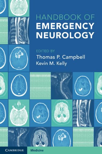 Handbook of Emergency Neurology