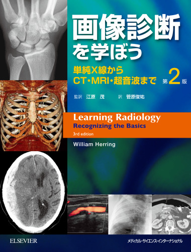 画像診断を学ぼう; Learning Radiology: Recognizing The Basics