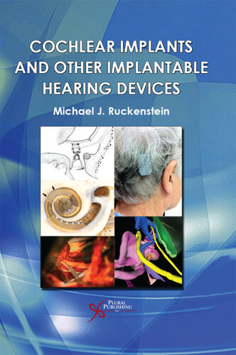 Cochlear Implants and Other Implantable Hearing Devices