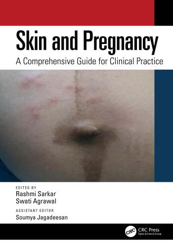 Skin and Pregnancy - A Comprehensive Guide for Clinical Practice (Nov 29, 2024)_(1032583479)_(CRC Press).rar