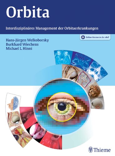 Orbita: Interdisziplinäres Management der Orbitaerkrankungen. Plus Online-Version in der eRef