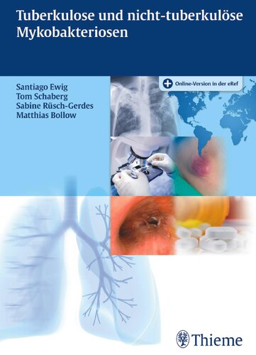 Tuberkulose und nicht tuberkulöse Mykobakteriosen