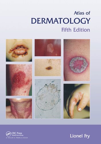 Atlas of Dermatology