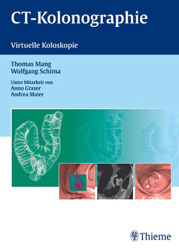 CT - Kolonographie: Virtuelle Koloskopie