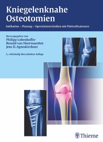 Kniegelenknahe Osteotomien: Indikation - Planung - Operationstechniken mit Plattenfixateuren