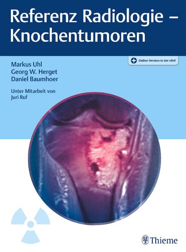 Referenz Radiologie - Knochentumoren