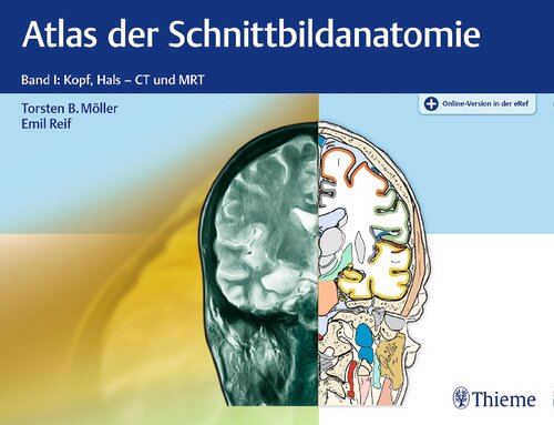 Atlas der Schnittbildanatomie: Band I: Kopf, Hals