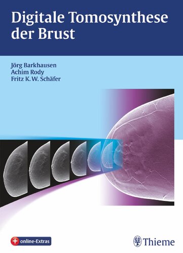 Digitale Tomosynthese der Brust: Plus online-Extras