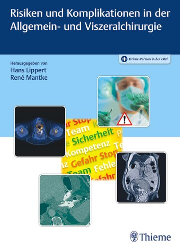 Risiken und Komplikationen in der Allgemein- und Viszeralchirurgie