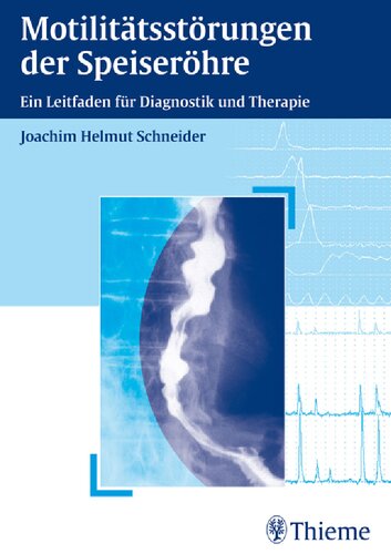 Motilitätsstörungen der Speiseröhre: Ein Leitfaden für Diagnostik und Therapie