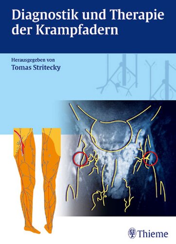 Diagnostik und Therapie der Krampfadern. Mit CD-ROM