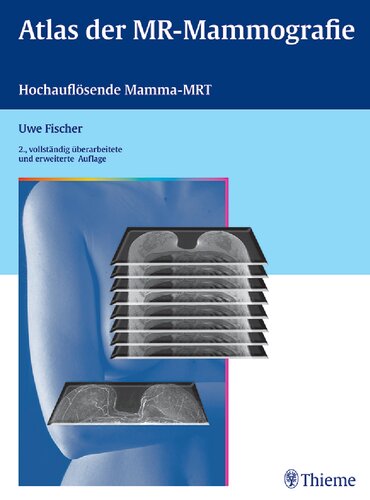 Atlas der MR-Mammographie: Hochauflösende Mamma-MRT