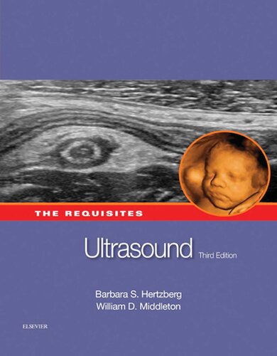 Ultrasound: The Requisites