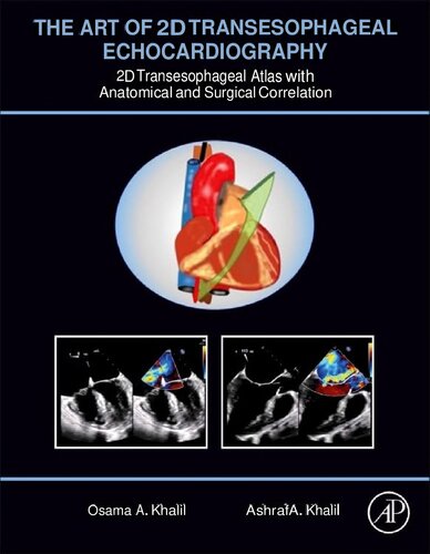 The Art of 2D Transesophageal Echocardiography: 2D Transesophageal Atlas with Anatomical and Surgical Correlation