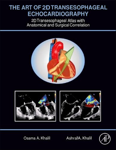The Art of 2D Transesophageal Echocardiography - 2D Transesophageal Atlas with Anatomical and Surgical Correlation (Feb 19, 2024)_(0443187983)_(Academic Press)