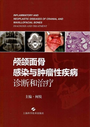 颅颌面骨感染与肿瘤性疾病：诊断和治疗