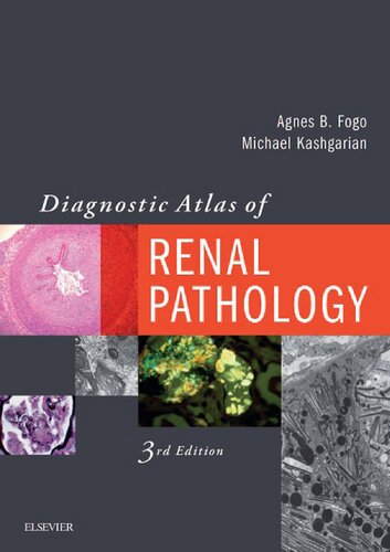 Diagnostic Atlas of Renal Pathology