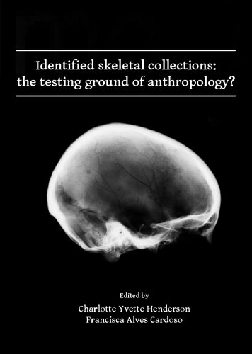 Identified skeletal collections: the testing ground of anthropology?