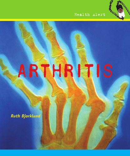 Arthritis (Health Alert)
