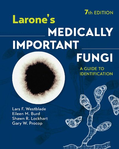 Larone's medically important Fungi: A guide to identification