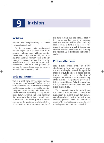 An Approach to Successful  Tympanoplasty