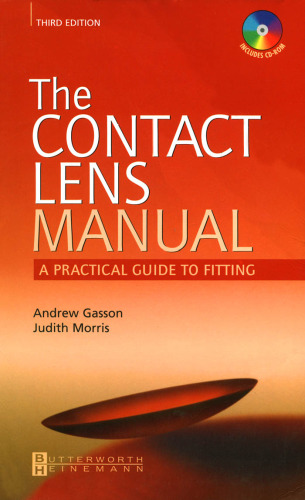 The Contact Lens Manual -- A Practical Guide to Fitting