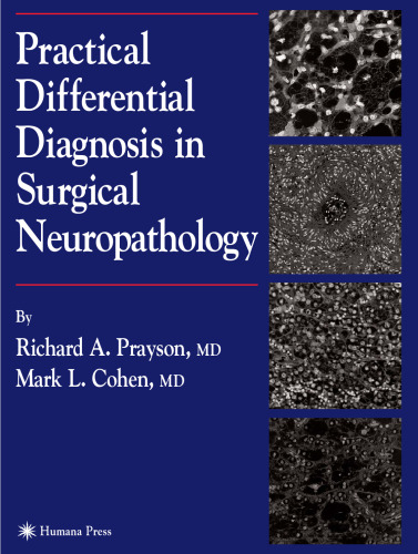 Practical Differential Diagnosis in Surgical Neuropathology