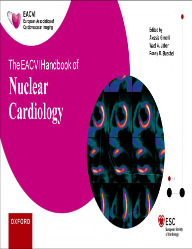The EACVI: Handbook of Nuclear Cardiology
