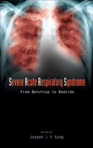 Severe Acute Respiratory Syndrome: From Benchtop to Bedside