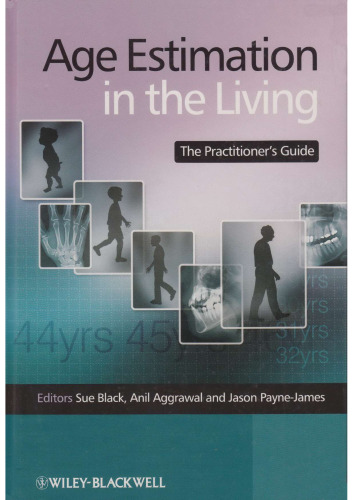 Age Estimation in the Living