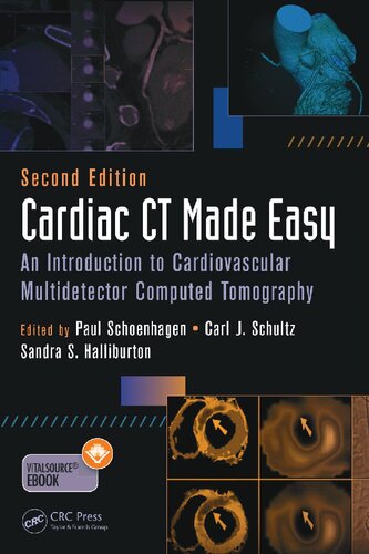 Cardiac CT made easy : an introduction to cardiovascular multidetector computed tomography